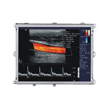 15 Inch Ultrasound Medikal ki monitè kè bebe